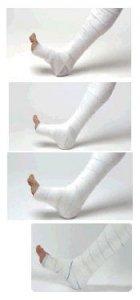 K4 K-Four Compression Bandage System Leg Ulcers 30cm+