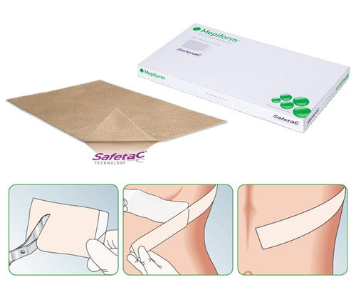 Mepiform with Safetac Technology Self Adherent Soft Silicone Sheeting 9cm x 18cm x 5 -   Molnlycke EasyMeds Pharmacy